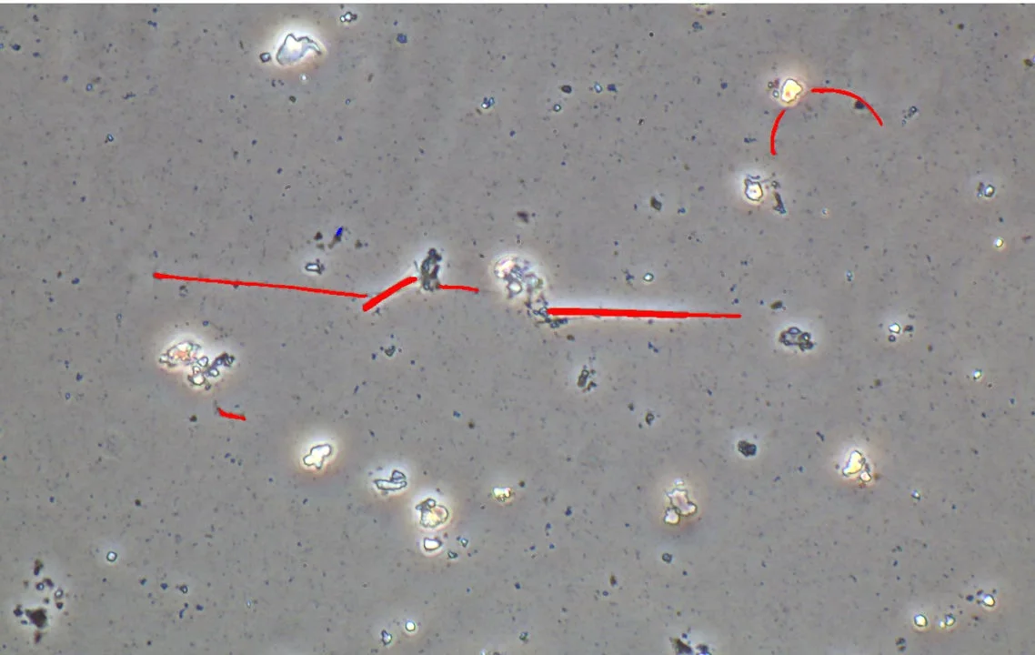 顕微鏡画像に赤い線で強調された粒子